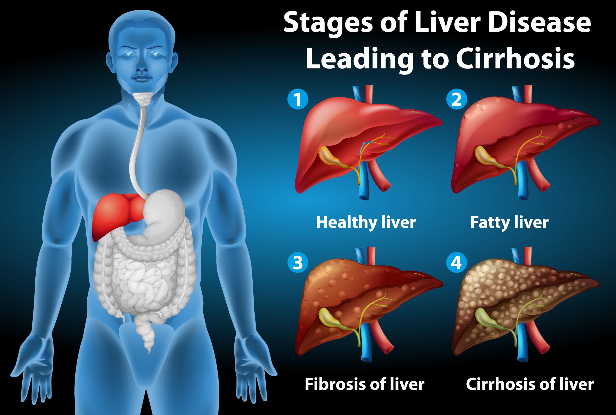 liver disease