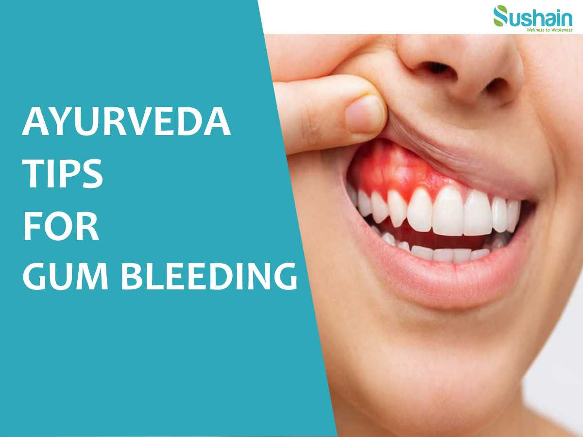 ayurveda tips for gum bleeding