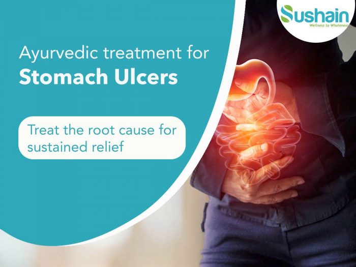 ayurvedic treatment for stomach ulcers