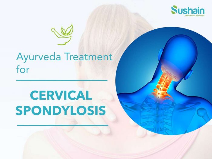 ayurveda treatment for cervical spondylosis